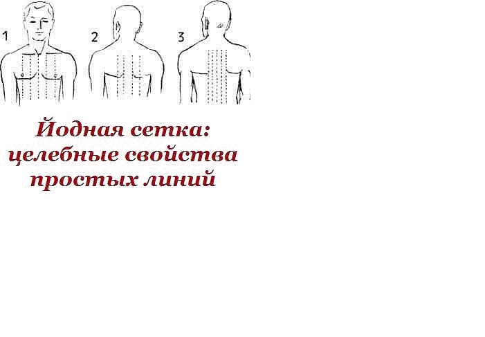 Йодная сетка при артрите Йодная сетка при артрите