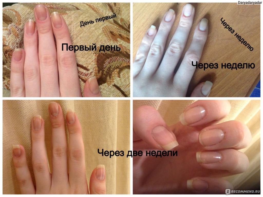 Прыщи на животе причины появления и лечение Прыщи из-за проблем с кишечником: о чем говорит появление