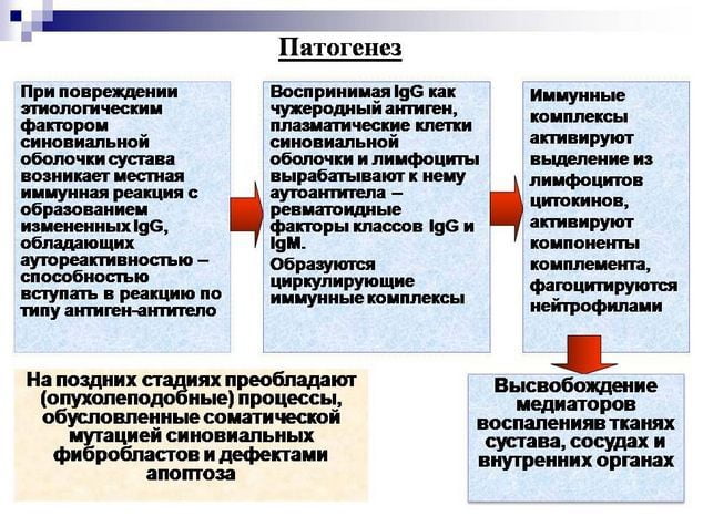 Артриты этиология клиника лечение Артриты этиология клиника лечение