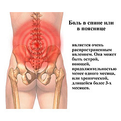 Болит спина в области поясницы к какому врачу обратится Болит спина в области поясницы к какому врачу обратится