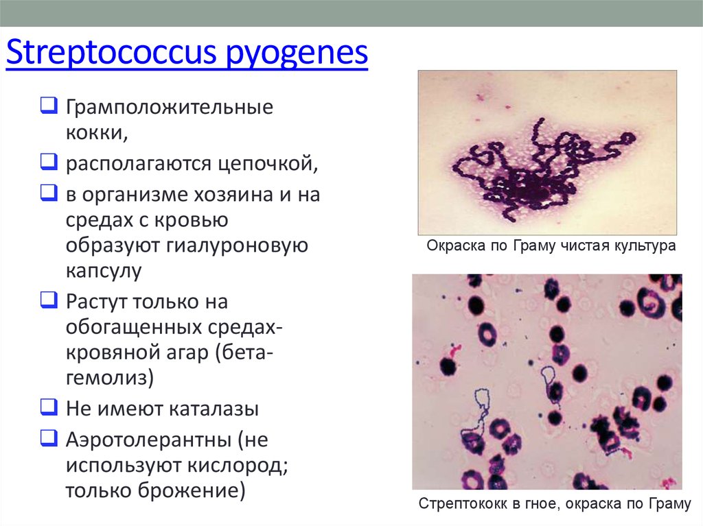 Streptococcus pyogenes в гинекологии