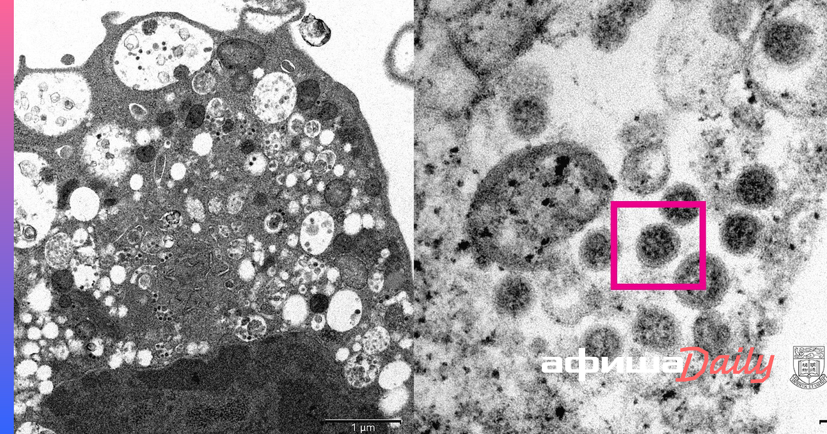 Университет гонконга опубликовал изображение омикрона